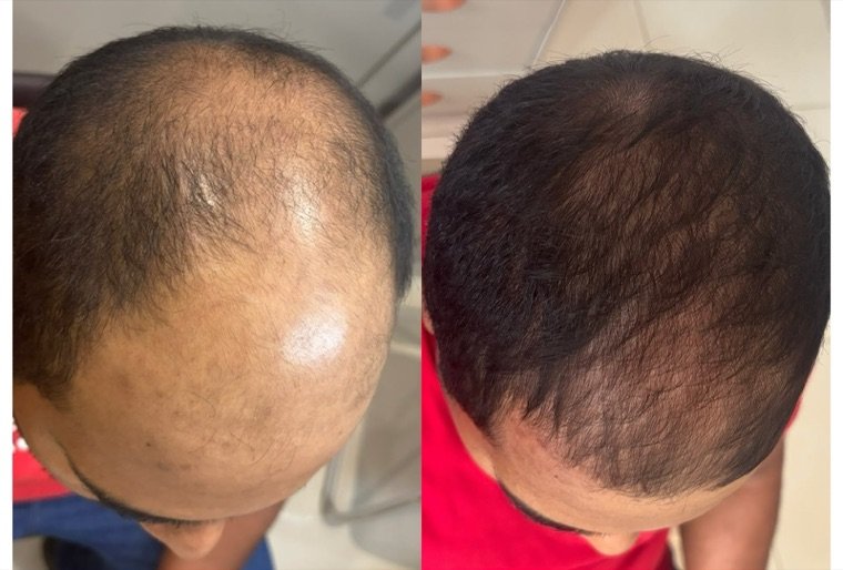 Antes e depois: resultado no Instituto Fernanda Ramalho