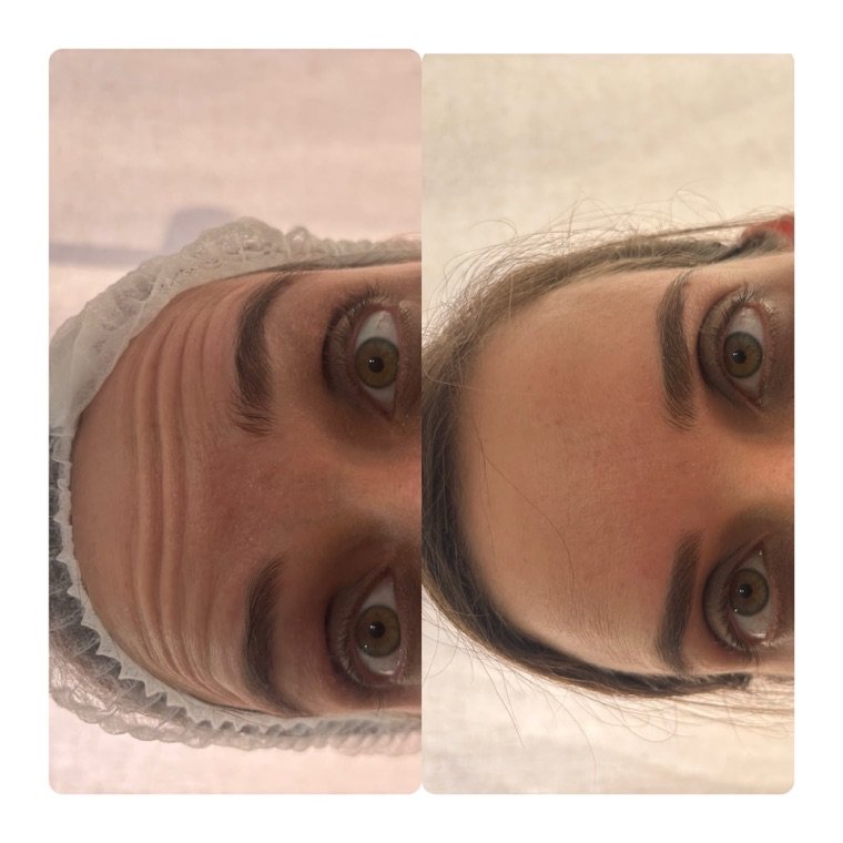 Antes e depois: resultado no Instituto Fernanda Ramalho