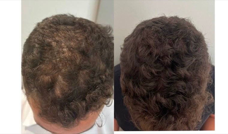 Antes e depois: resultado no Instituto Fernanda Ramalho