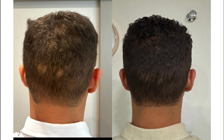 Antes e depois: resultado no Instituto Fernanda Ramalho