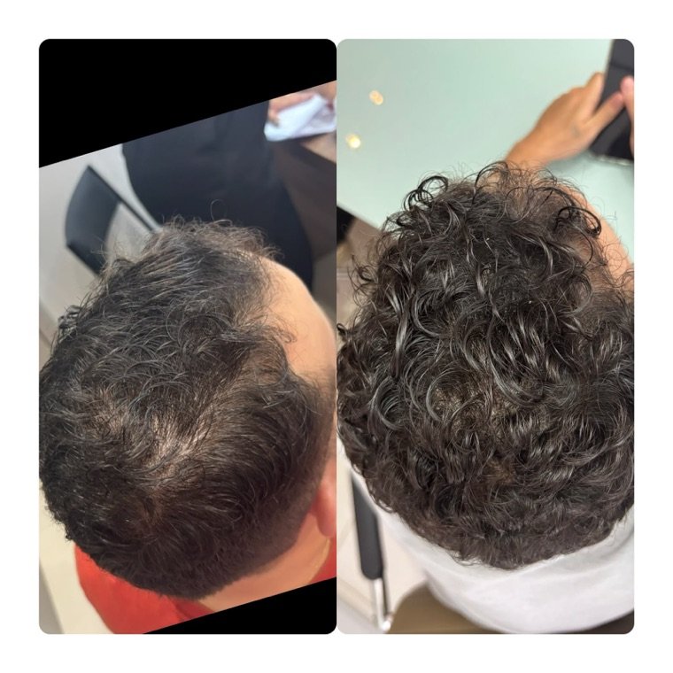 Antes e depois: resultado no Instituto Fernanda Ramalho
