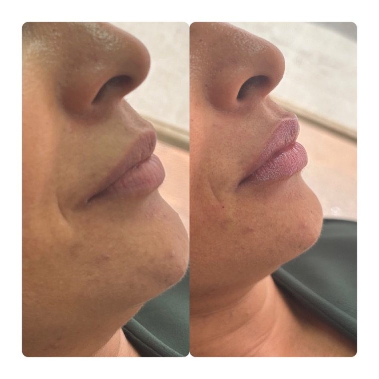 Antes e depois: resultado no Instituto Fernanda Ramalho