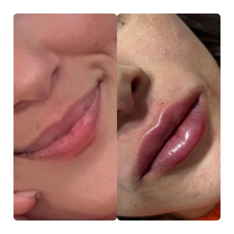 Antes e depois: resultado no Instituto Fernanda Ramalho