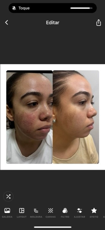 Antes e depois: resultado no Instituto Fernanda Ramalho