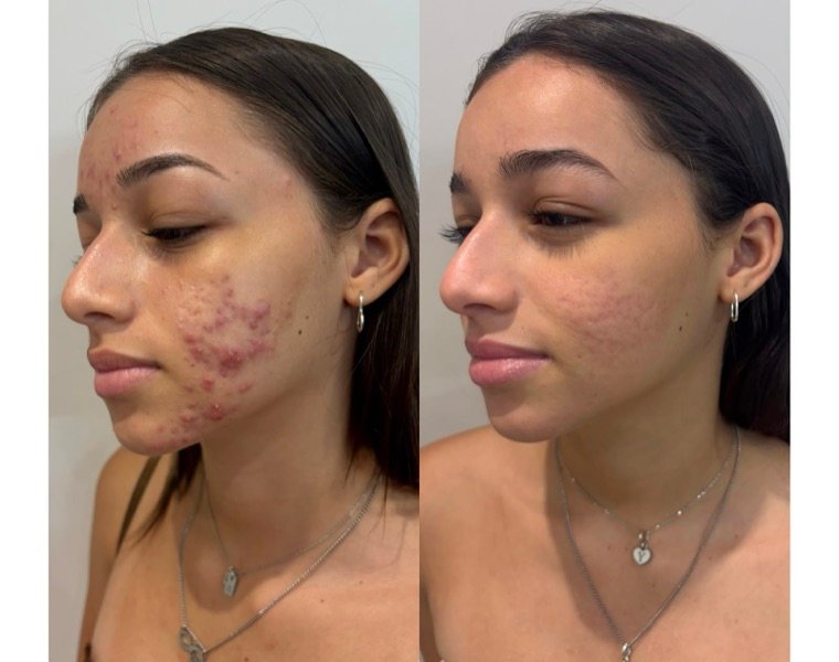 Antes e depois: resultado no Instituto Fernanda Ramalho