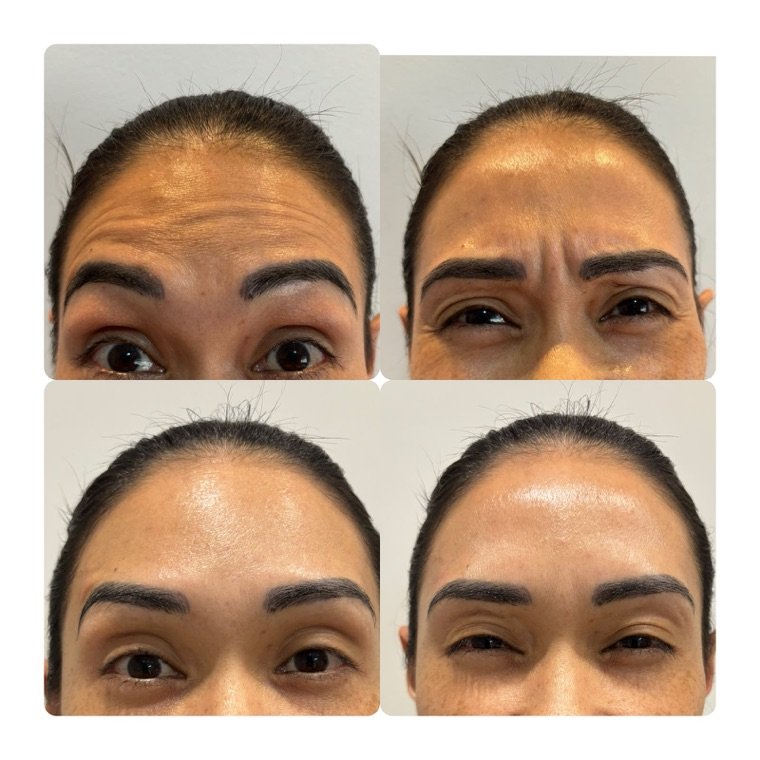 Antes e depois: resultado no Instituto Fernanda Ramalho