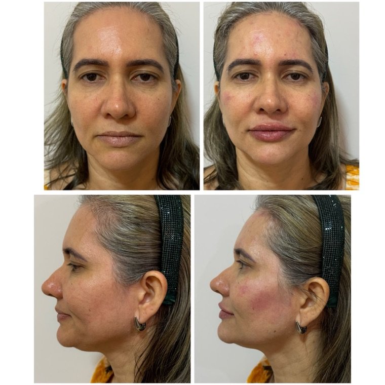 Antes e depois: resultado no Instituto Fernanda Ramalho