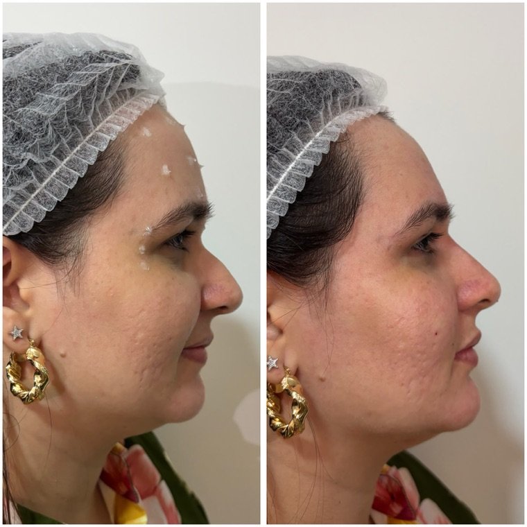 Antes e depois: resultado no Instituto Fernanda Ramalho