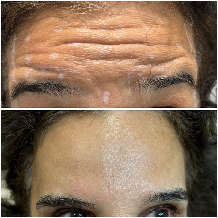 Antes e depois: resultado no Instituto Fernanda Ramalho