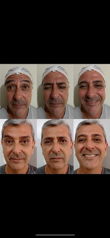Antes e depois: resultado no Instituto Fernanda Ramalho