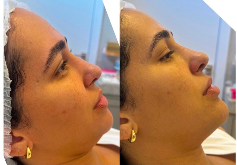 Antes e depois: resultado no Instituto Fernanda Ramalho